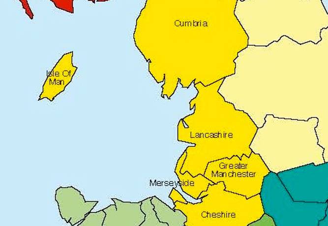 West Midlands v North West study of tooth extractions under a GA
